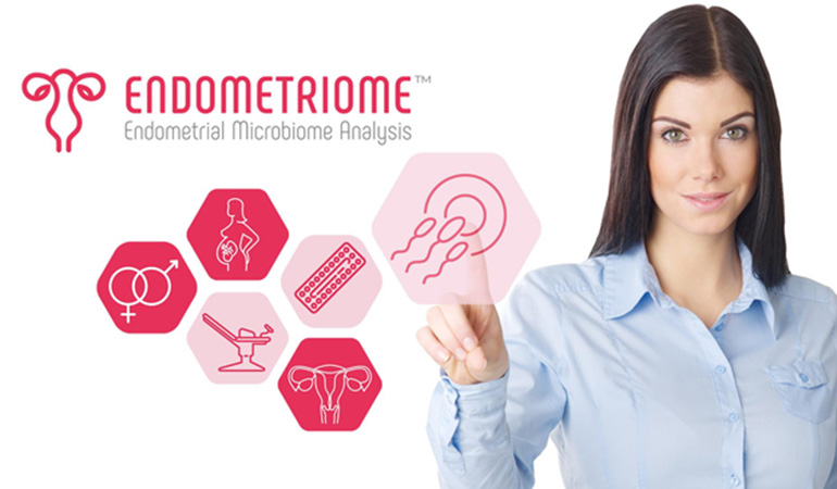 endometriome