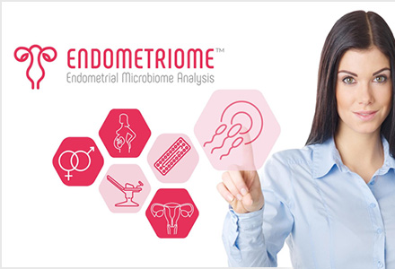 endometriome